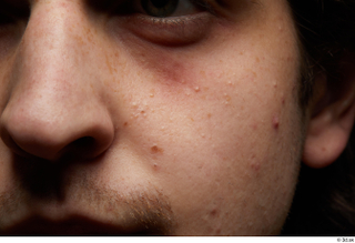 HD Face Skin Waylon Crosby cheek face nose skin pores…